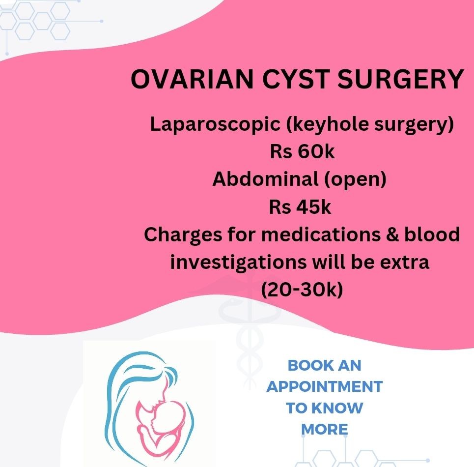 Ovarian cystectomy, cyst removal 