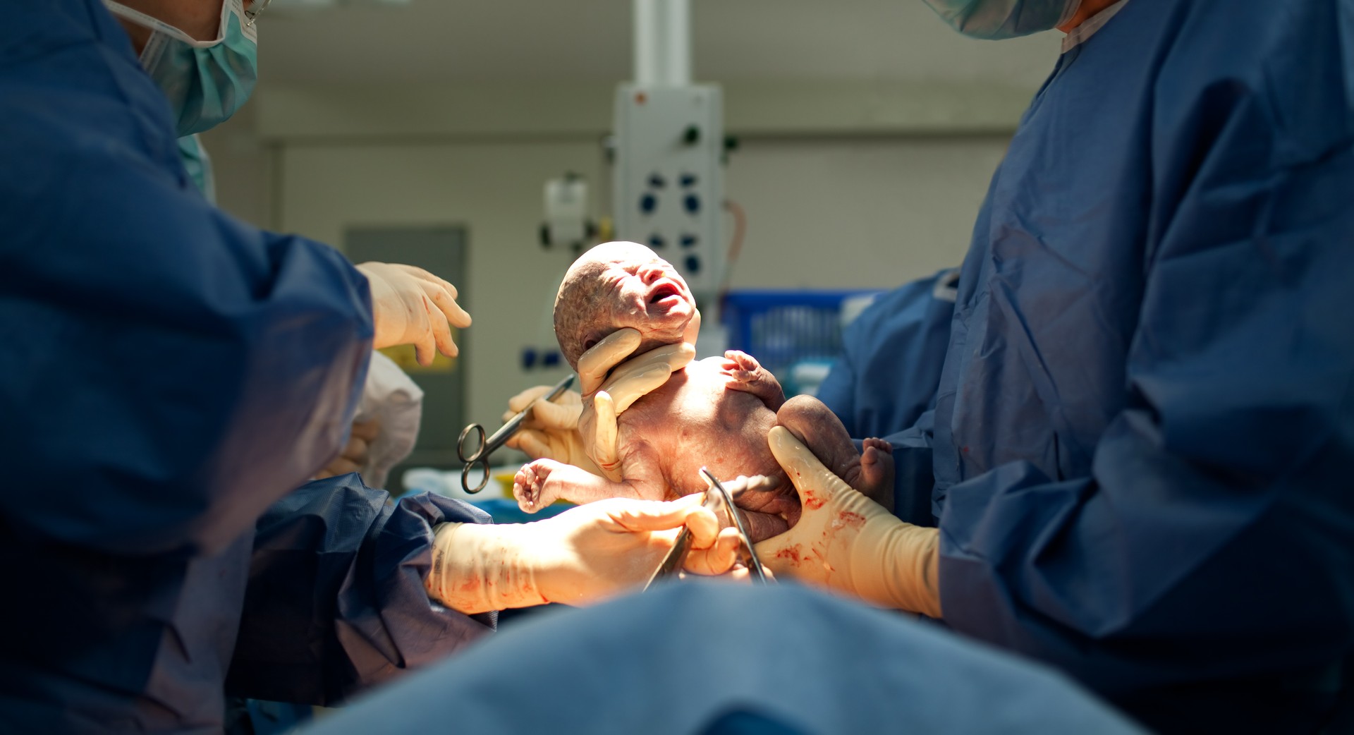 Caesarean Section, c-section 